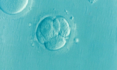 Zarodek w płynie owodniowym, zdjęcie w kolorze morskiego błękitu 